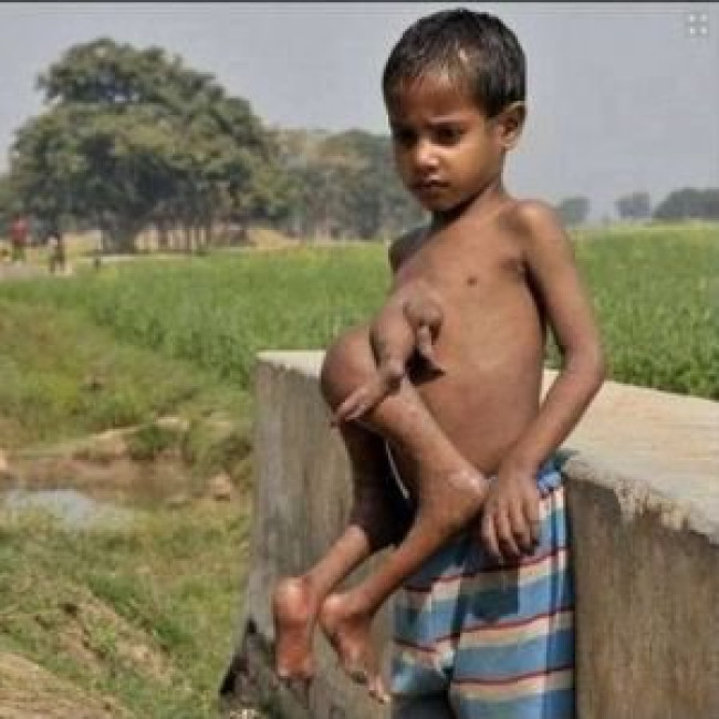 অদ্ভুদ মানব জন্ম! অদ্ভুদ মানব জন্ম!